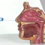 Nasal Anatomy - Swab Insertion