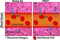 HBOT Plasma Oxygen