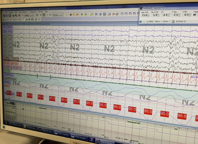 Sleep Study Data Image Sleep Disorders – Testing & Treating | Biotoxin Journey